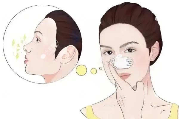 郑州鼻修复医生排名top10:赵绛波