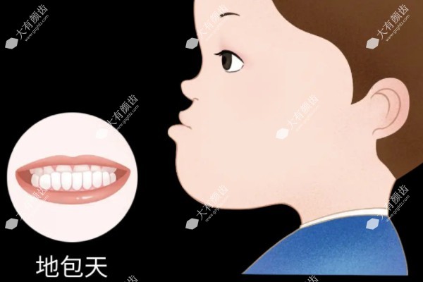 儿童反颌能自愈吗www.fakemusicmedia.com