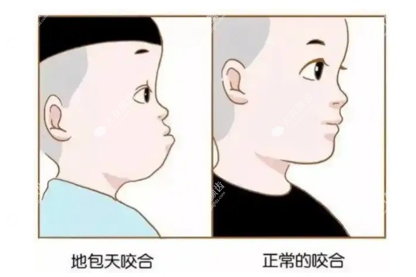 儿童反颌能自愈吗www.fakemusicmedia.com