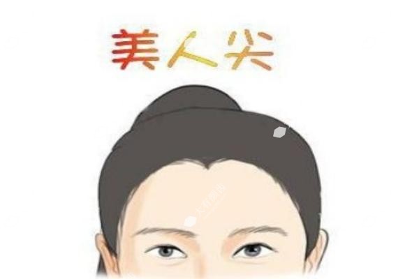 南京种植美人尖医院有哪些