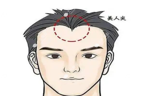 南京种植美人尖医院有哪些