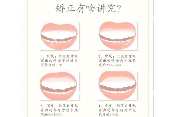 儿童笑露牙龈怎么矫正
