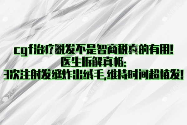 cgf治疗脱发是智商税吗