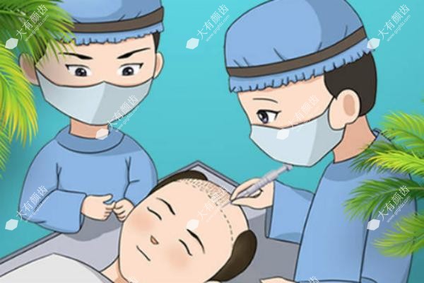 广州植发多少钱一个毛囊