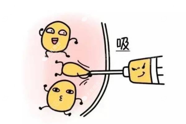 唐国强医生吸脂价格是多少