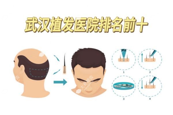武汉植发医院排名前十www.fakemusicmedia.com