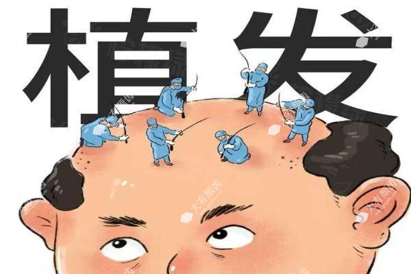 碧莲盛植发3000单位价格