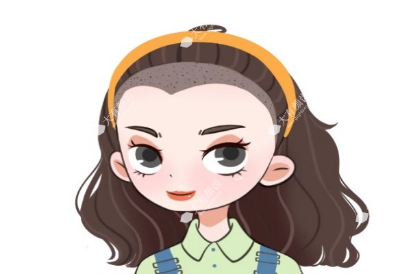 发际线种植一般需要多少钱呢2.jpg