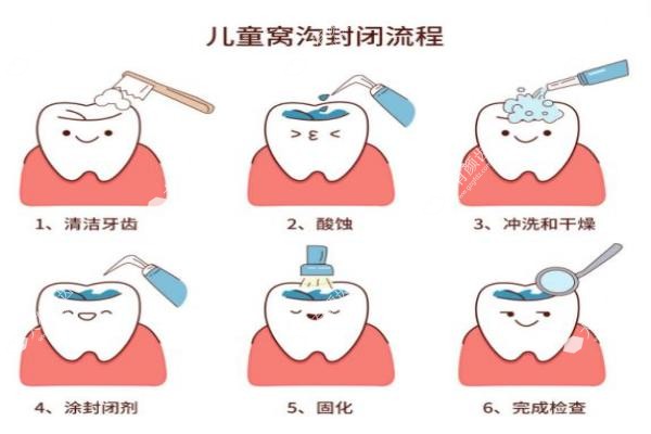儿童窝沟封闭的害处和好处fakemusicmedia.com20250519156959.jpg