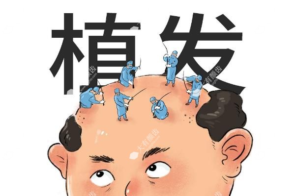 植发到底好不好,可以坚持多长时间？详看解答+植发2025价格一览表