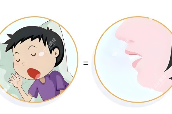 儿童长期用口呼吸有什么危害？公布3大危害，附治疗方法