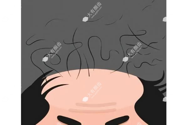 物理增发和植发哪个价格高