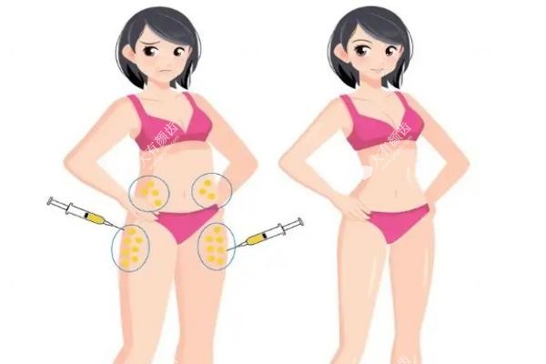赵军舰吸脂怎么样