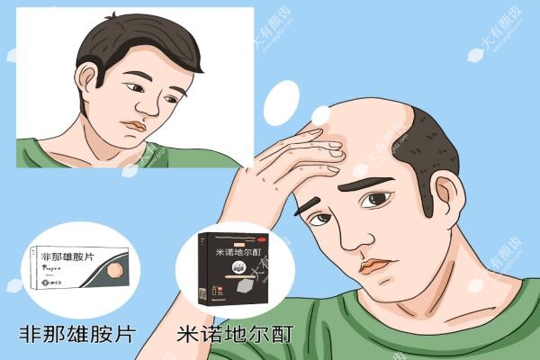 50岁秃顶了怎么治疗