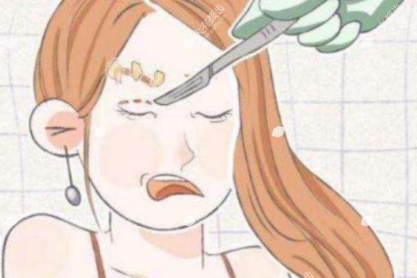 吕方中医生修复双眼皮怎么样