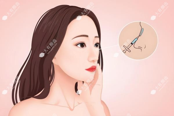 鼻修复手术一般多少钱？.jpg