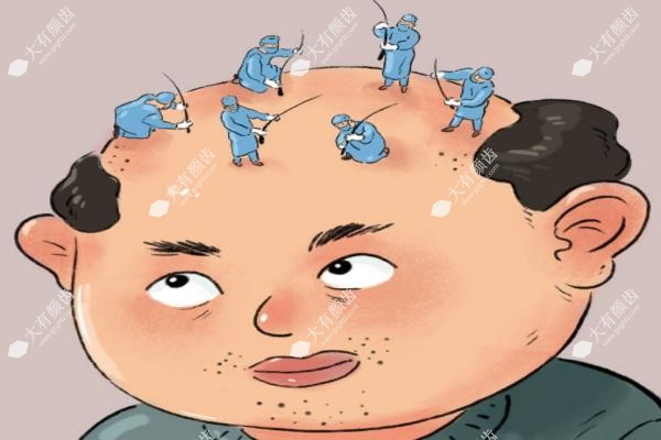 植发可以取两侧头发吗.jpg