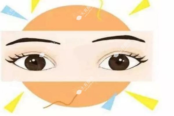 上海朱迪双眼皮修复实例.jpg