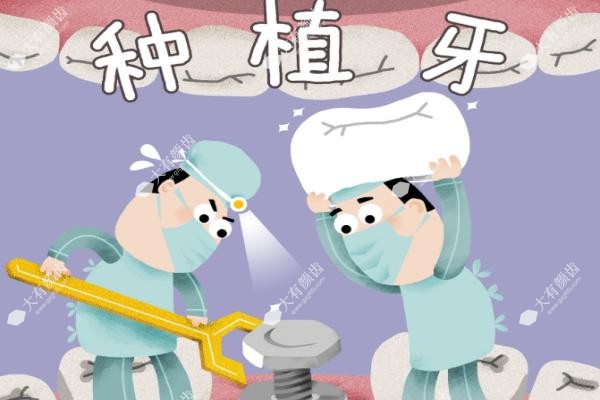 瑞典种植体和瑞士种植体的区别.jpg